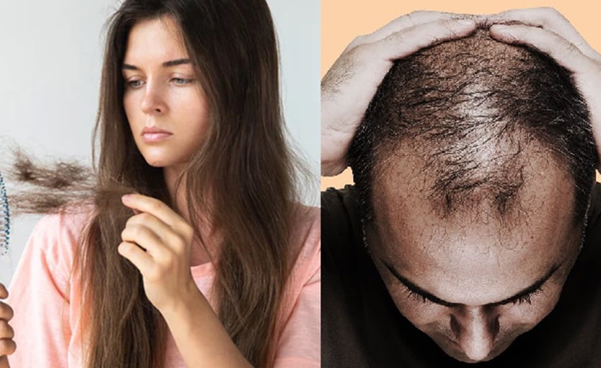 Hair Fall Control : बालों को झड़ने से रोकने में फायदेमंद है ग्रीन टी, जानिए कैसे है उपयोगी