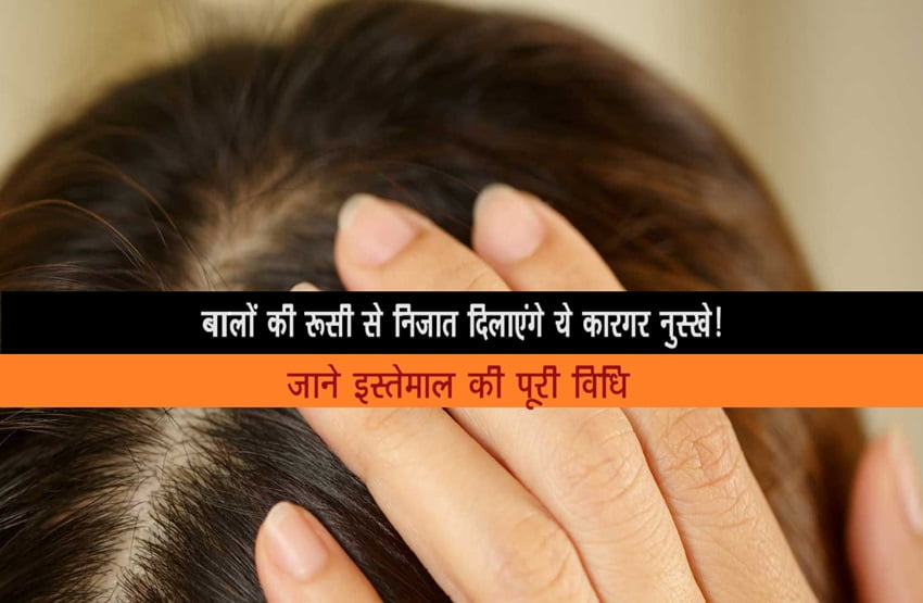 Hair Dandruff Removal Home Remedies : बच्चों के सिर में है रूसी, इन उपायों से हो सकता है समस्या का समाधान