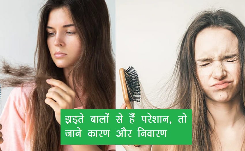 Hair Fall control Tips : बालों का झड़ना बनी आम समस्या, किशोर-किशोरियों के भी गिर रहे बाल, आखिर कैसे रोकें हेयर फॉल