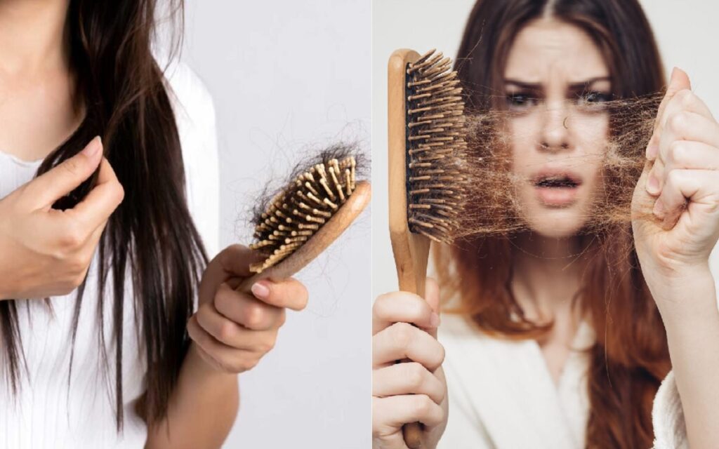 Hair Fall control Tips : बालों का झड़ना बनी आम समस्या, किशोर-किशोरियों के भी गिर रहे बाल, आखिर कैसे रोकें हेयर फॉल