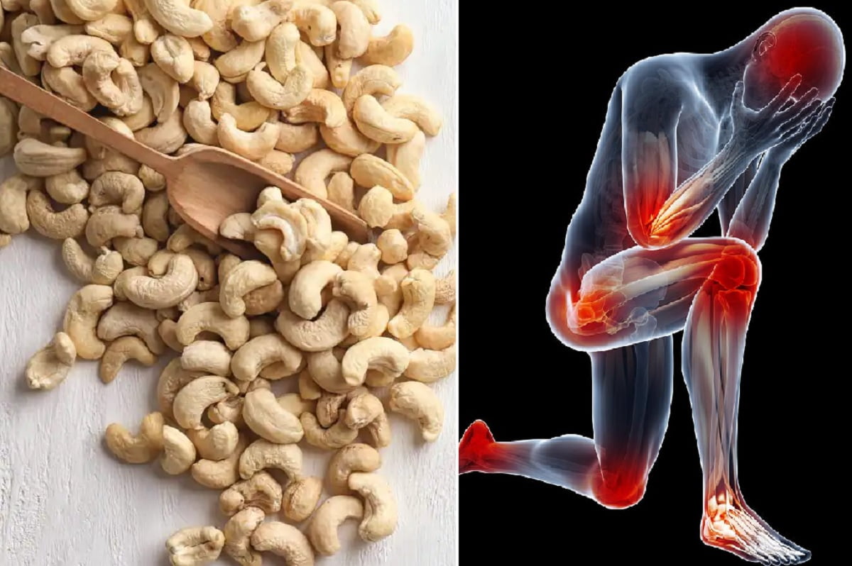 kaju health benefits : दर्द और सूजन को कम करता है काजू, नियमित रूप से करे सेवन