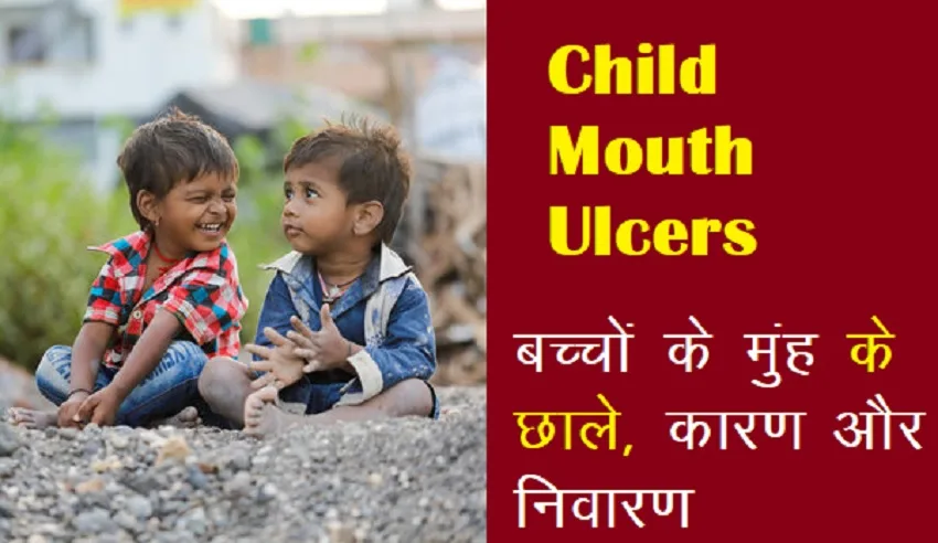 Child Mouth Ulcers : इन पोषक तत्वों की कमी के कारण बच्चों के मुंह में आते हैं छाले, आखिर क्या है ईलाज