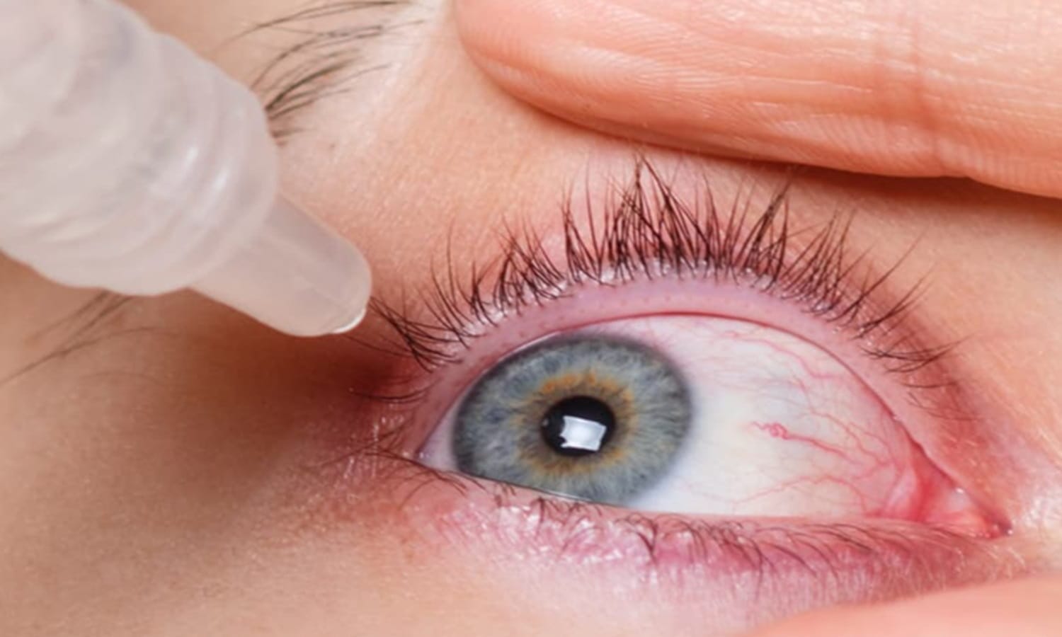 Dry Eye Symptoms And Treatment : महिलाओं और बच्चों में बढ़ी आंख की बीमारी ड्राइनेस, जानिए क्या कहते हैं विशेषज्ञ